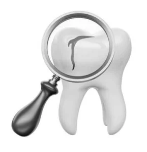 Tooth Chipped at Gum Line, No Pain? Here’s What It Means and How to Treat It 37 Tooth Chipped at Gum Line No Pain illustration