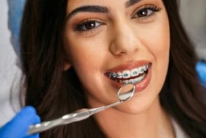 What Happens If You Have a Loose Tooth With Braces: When to Act and Why It Occurs 38 smiling woman with braces undergoing dental check up