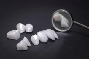 Benefits of Dental Veneers: What They Can and Can’t Do for Your Teeth 35 veneer shells lined up with dental mirror