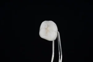 Types of Dental Fillings: What Are Your Options? 35 filling chipped tooth shell