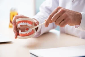 Veneers vs Crowns vs Bonding: What’s the Difference and Which May Suit You? 39 mouth model used-by a dentist